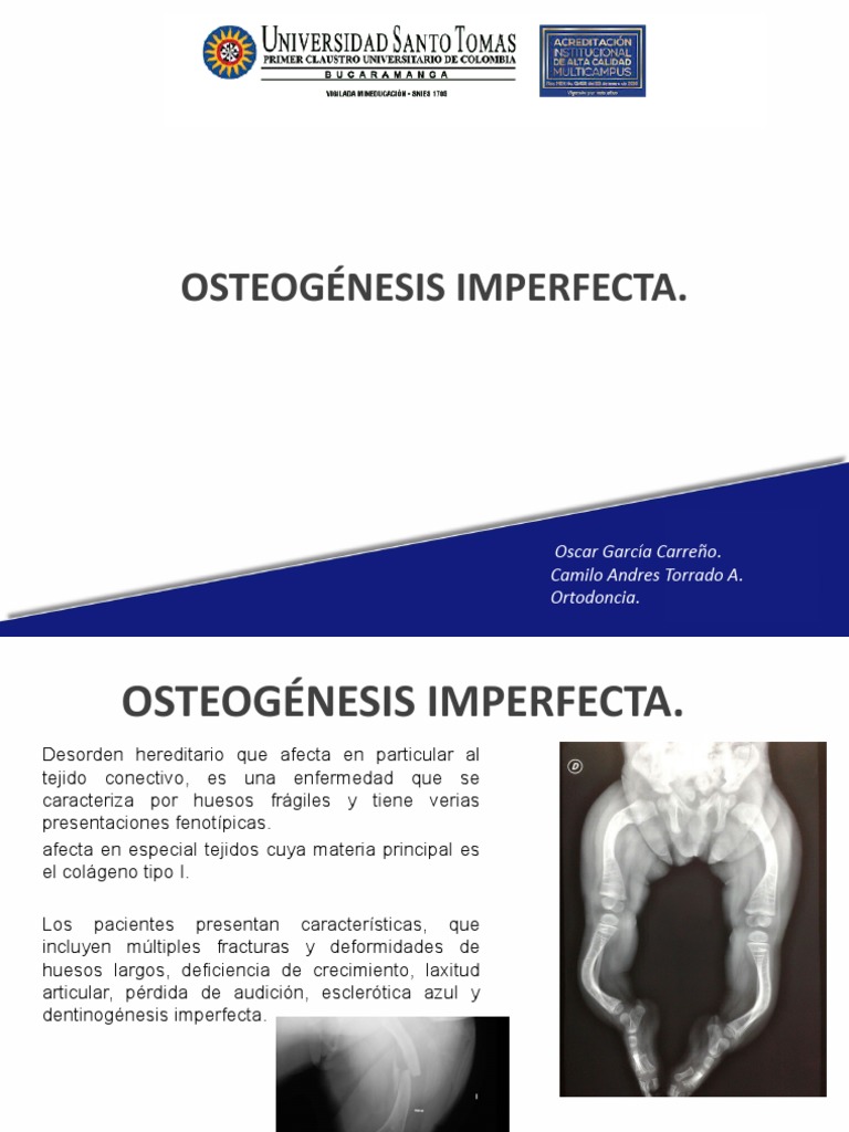 osteogenesis-imperfecta-pdf-hueso-medicina-clinica