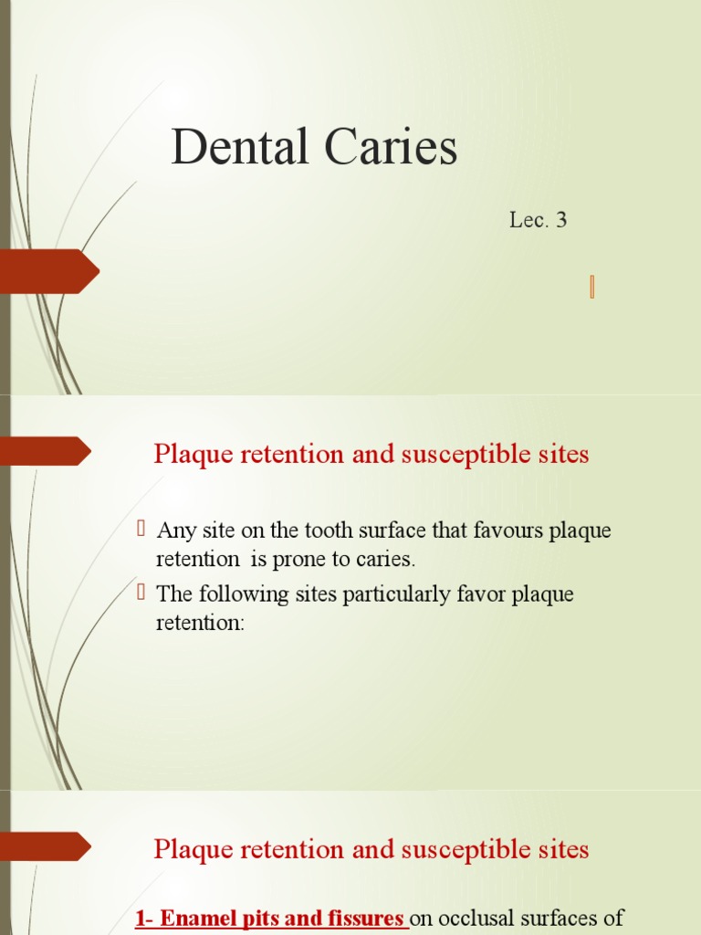 Susceptible Sites for Dental Caries A Focus on Plaque Retention and