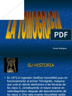 Historia y funcionamiento del Tomógrafo