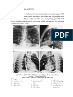 Gambaran Abnormal Lainnya