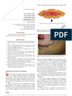 A-Plasty Scar Revision Technique