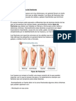 Clasificación y Tipos de Fracturas