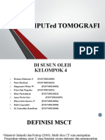 Computed Tomografi