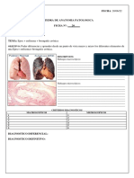 Ficha 20 - EPOC + Enfisema + Bronquitis Crónica