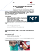 Pasos Operatorios para La Colocación de Sellantes Dentales en Odontopediatría