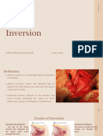 Uterine Inversion: Pineda, Edrianna Kassandra B. June 9, 2022