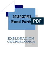 Exploración Colposcópica