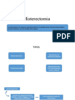 Histerectomia - Tipos e Indicaciones