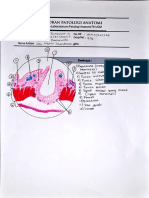 REDRAW_[REG 2020] Chronic Diverticultitis_Klp 7_22623_Cantika Prameswari Hananto_ Pathology of Gastrointestinal Tract_PA.pdf