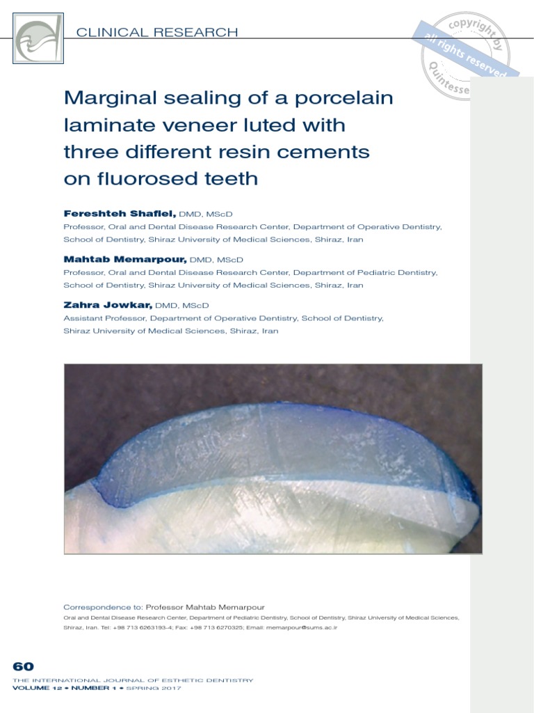 Marginal Sealing of A Porcelain Laminate Veneer | PDF | Tooth Enamel ...