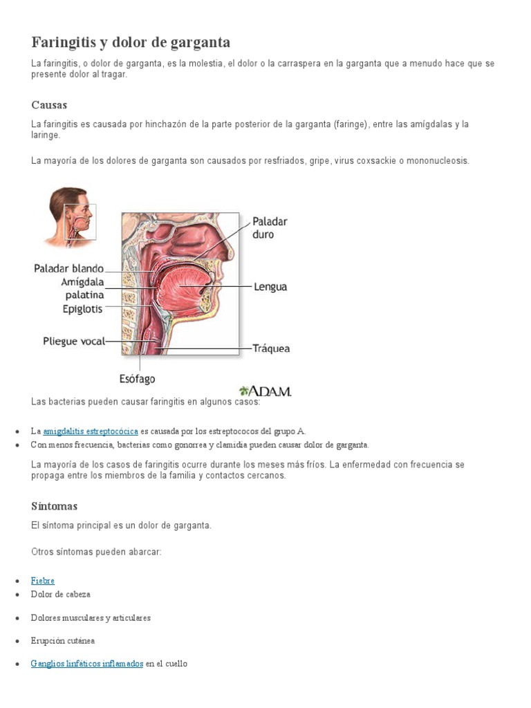 Faringitis y Dolor de Garganta | PDF | Dolor de cabeza | Migraña