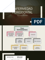 Enfermedad Periodontal