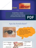 AINEI PPT Hordeolum FIX