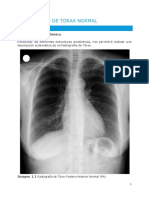 Radiografía de tórax normal guía