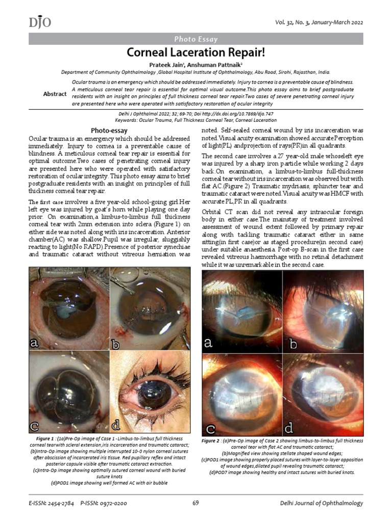 Corneal Laceration Repair PDF Cornea Cataract