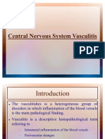 vasculitis