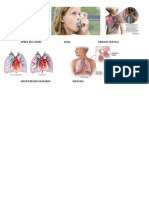 Apnea Del Sueñoasma Fibrosis Quistica