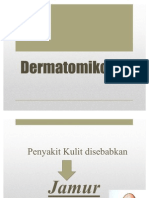 Dermatomikosis