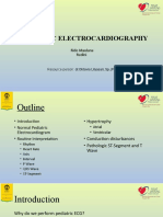 Rido, Rudini - Paediatric ECG