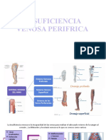 Insuficiencia Venosa Perifrica