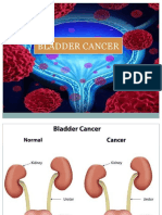 Cancer of The Bladder