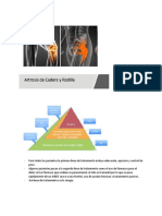 Artrosis de Cadera y Rodilla