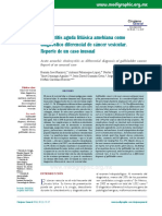 Colecistitis Aguda Litiásica Amebiana Como Diagnóstico Diferencial de Cáncer Vesicular. Reporte de Un Caso Inusual