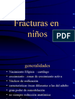 Fractura Niños