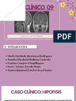 Caso - Clinico - Hipofisis Numero 9