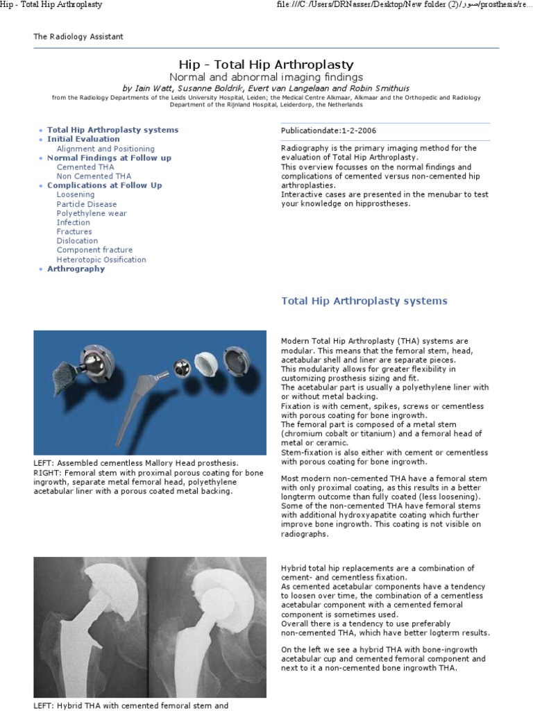 Hip - Total Hip Arthroplasty | PDF | Hip | Infection