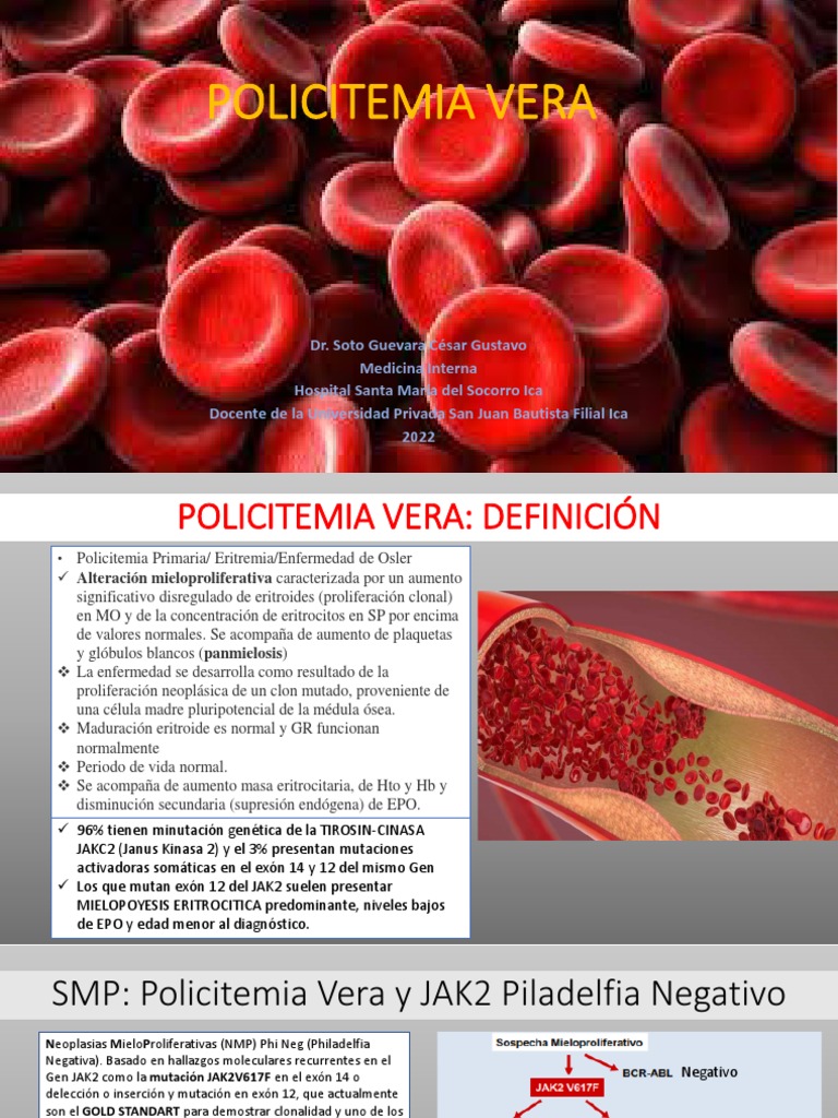 Policitemia Vera | PDF | Mutación | Medicina CLINICA