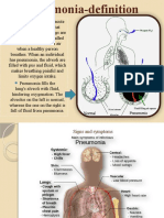 Pneumonia Engleza