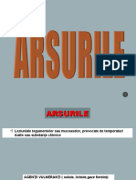 Arsurile