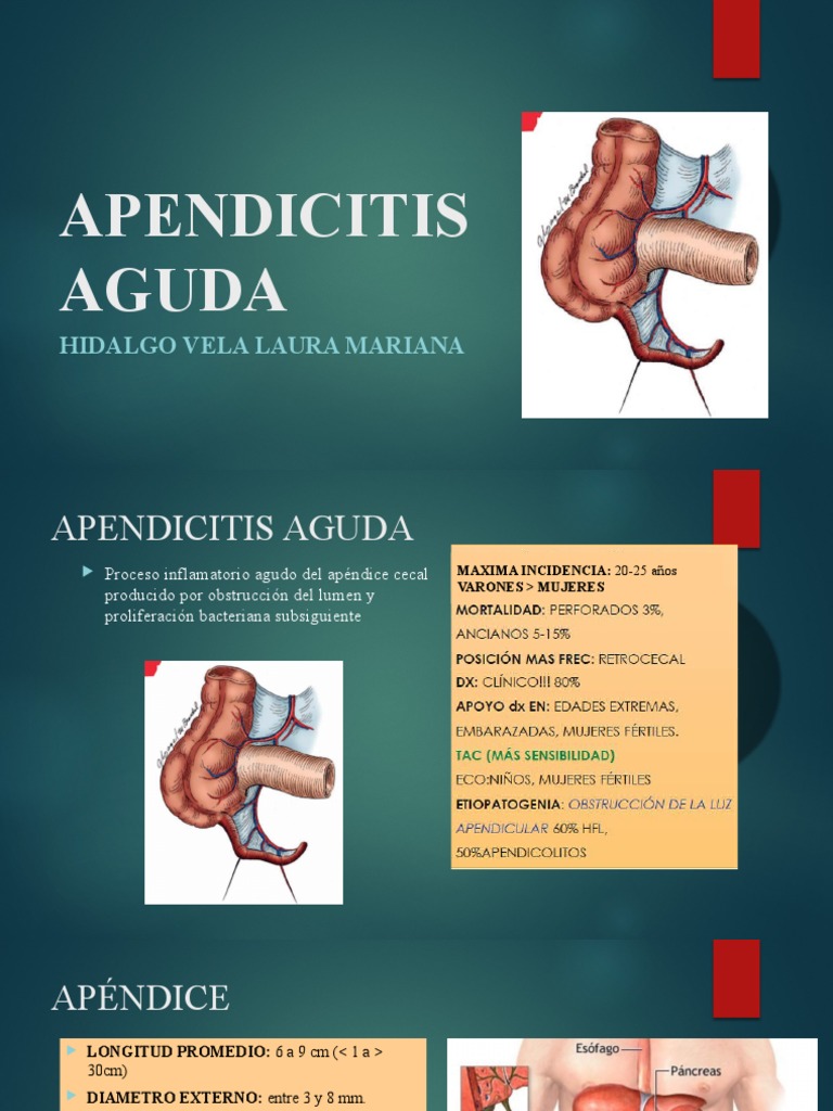 Apendicitis Aguda PDF Epidemiología Especialidades Medicas