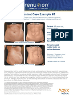 Abdominal Case Example #1: 2 Yrs Post-Op Before