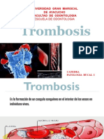 4 Trombosis
