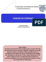 Cancer de Esofago
