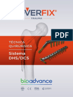 OVERFIX - Trauma Tecnica - Quirurgica Sistema DHS DCS