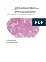 Tarefa patologia F2 vas 2020 2