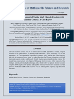 Conservative Treatment of Medial Shaft Clavicle Fracture With Borderline Criteria A Case Report