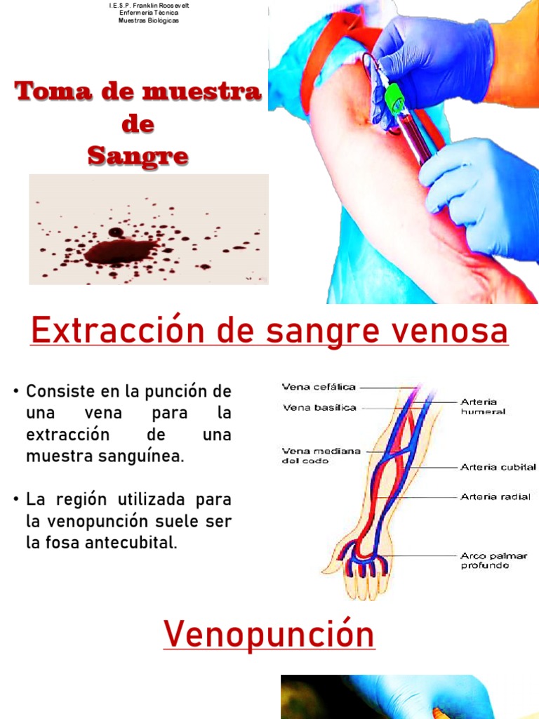 Semana 10 Sangre Arterial Y Venosa Pdf