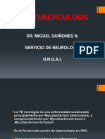 NEUROTUBERCULOSIS