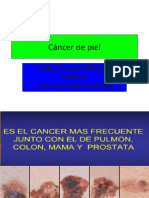 Cáncer de Piel