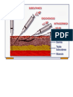 Parenteral Es