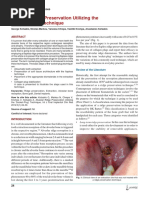 Alveolar Ridge Preservation Utilizing The Socket-Plug Technique