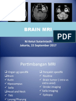 Mri Brain