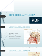 Hiperprolactinemia 2