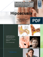 Hipoacusia