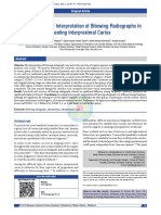 Evaluation of The Interpretation of Bitewing Radio