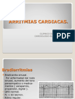 Arritmias Cardiacas